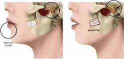 Kaaklijn Jawline Trainer Sport Fitness Kaak Trainer Gym Jawliner - Variant Advanced - Kaaklijn Onderkin Gezichtstrainer - Jawliner® -FitForce Outlet Winkel 1200x572